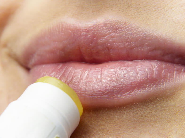 Les lèvres gercées sont un symptôme d'allergie à la nicotine